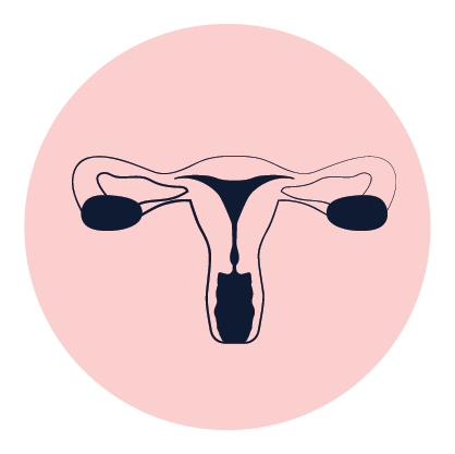 שחלות פוליציסטיות